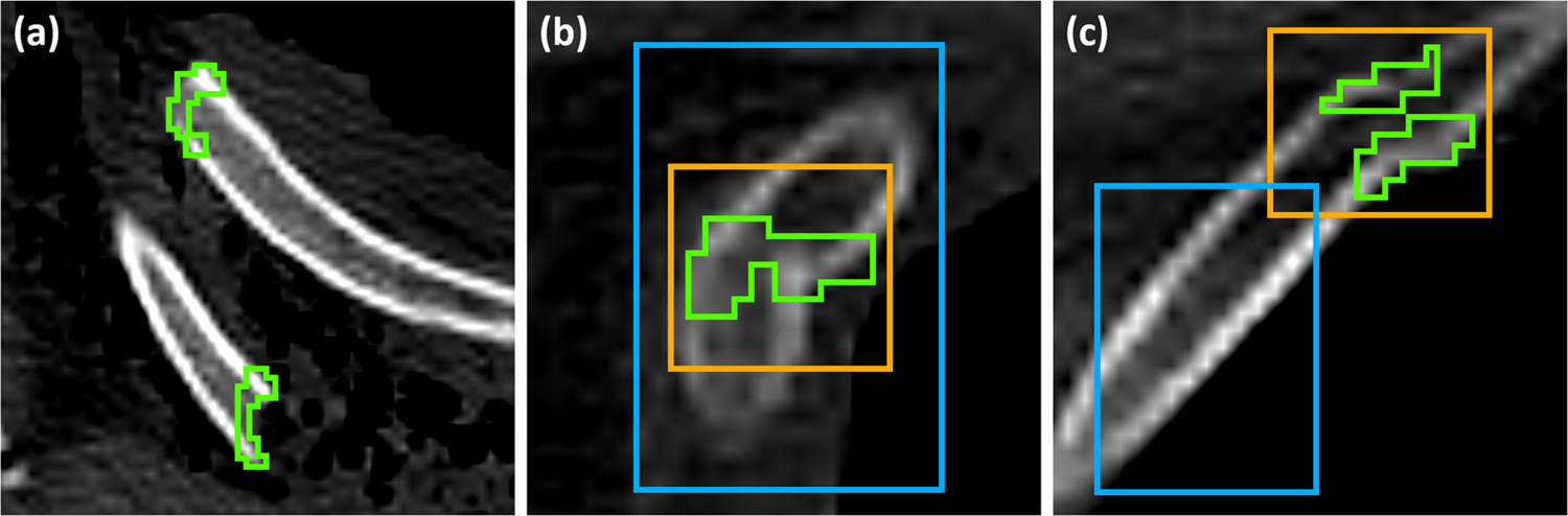PMRF detection